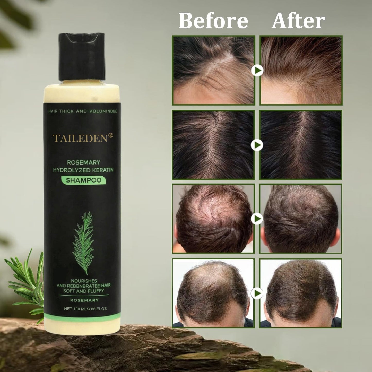 🔥Flash Sale 5K+ SOLD!✨🌱 Organic Rosemary Hair Growth Shampoo