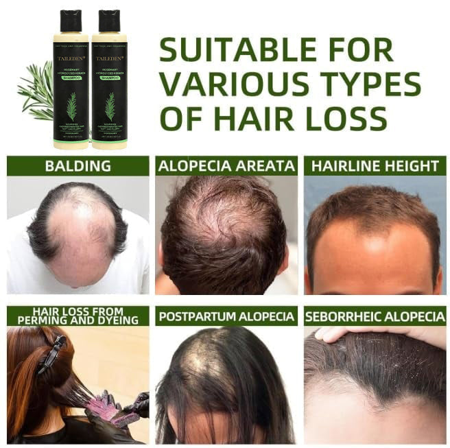 🔥Flash Sale 5K+ SOLD!✨🌱 Organic Rosemary Hair Growth Shampoo