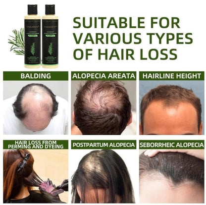 🔥Flash Sale 5K+ SOLD!✨🌱 Organic Rosemary Hair Growth Shampoo