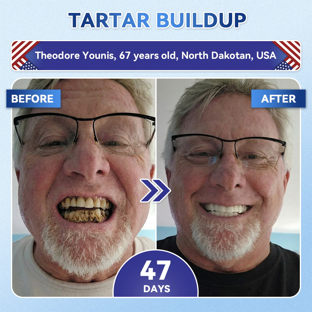 🔥Last Day 49% OFF🦷 Tideglusib Fast‑Dissolving Tooth & Gum Repair Oral Strips ✨