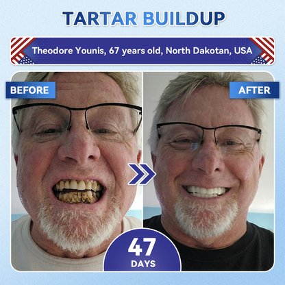 🔥Last Day 49% OFF🦷 Tideglusib Fast‑Dissolving Tooth & Gum Repair Oral Strips ✨