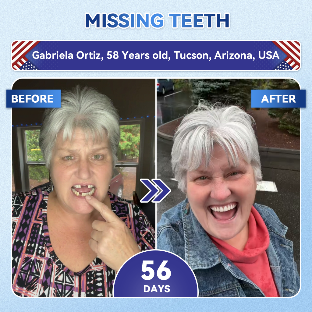 🔥Last Day 49% OFF🦷 Tideglusib Fast‑Dissolving Tooth & Gum Repair Oral Strips ✨