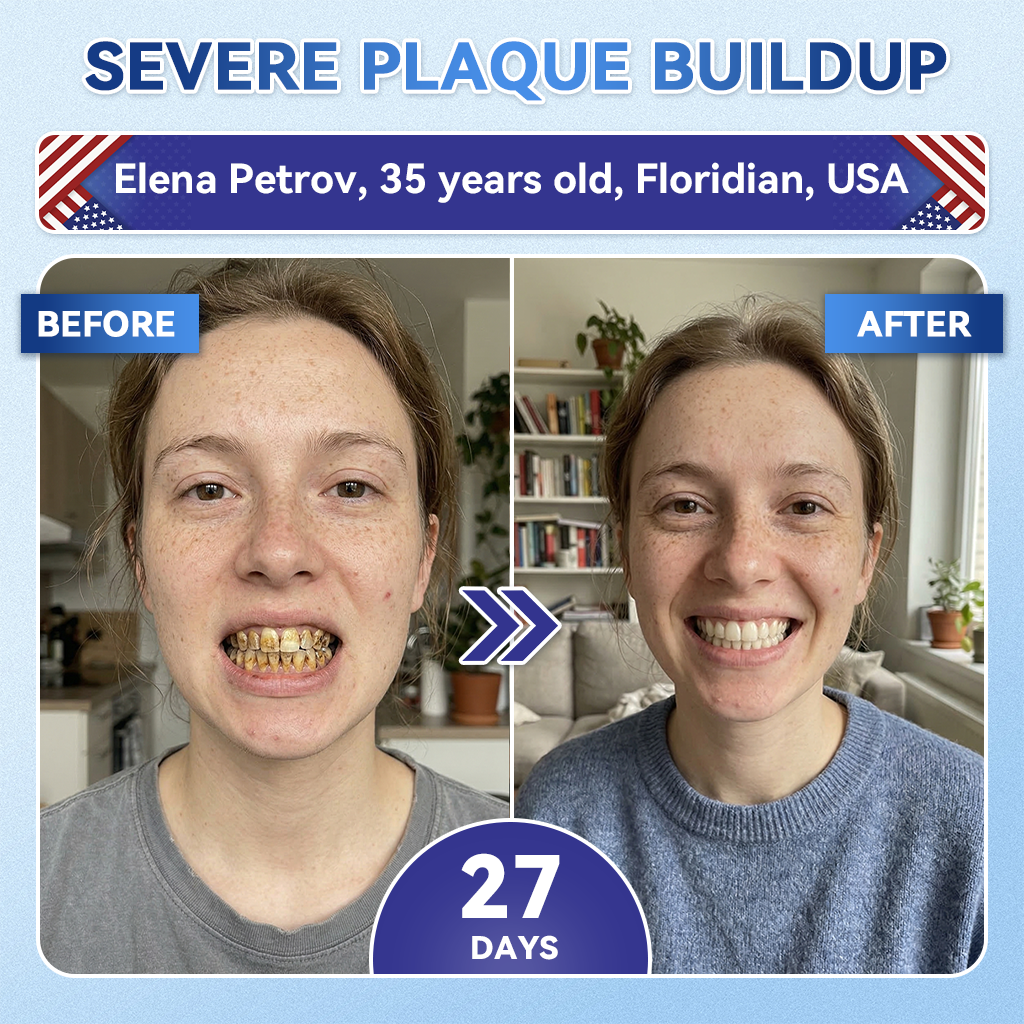 🔥Last Day 49% OFF🦷 Tideglusib Fast‑Dissolving Tooth & Gum Repair Oral Strips ✨