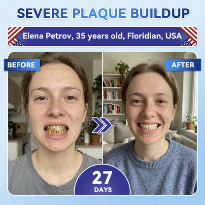 🔥Last Day 49% OFF🦷 Tideglusib Fast‑Dissolving Tooth & Gum Repair Oral Strips ✨