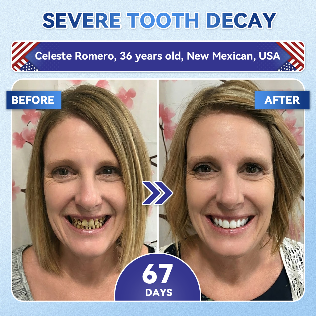 🔥Last Day 49% OFF🦷 Tideglusib Fast‑Dissolving Tooth & Gum Repair Oral Strips ✨