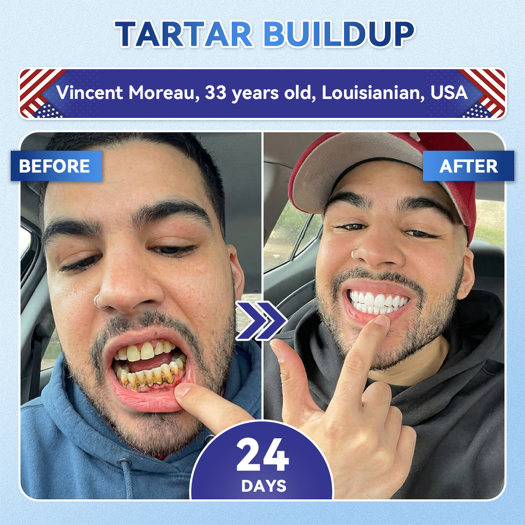 🔥Last Day 49% OFF🦷 Tideglusib Fast‑Dissolving Tooth & Gum Repair Oral Strips ✨