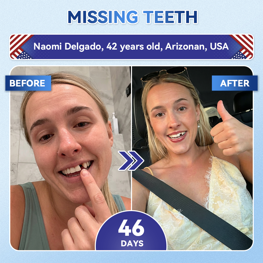 🔥Last Day 49% OFF🦷 Tideglusib Fast‑Dissolving Tooth & Gum Repair Oral Strips ✨