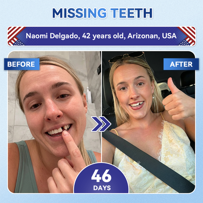 🔥Last Day 49% OFF🦷 Tideglusib Fast‑Dissolving Tooth & Gum Repair Oral Strips ✨