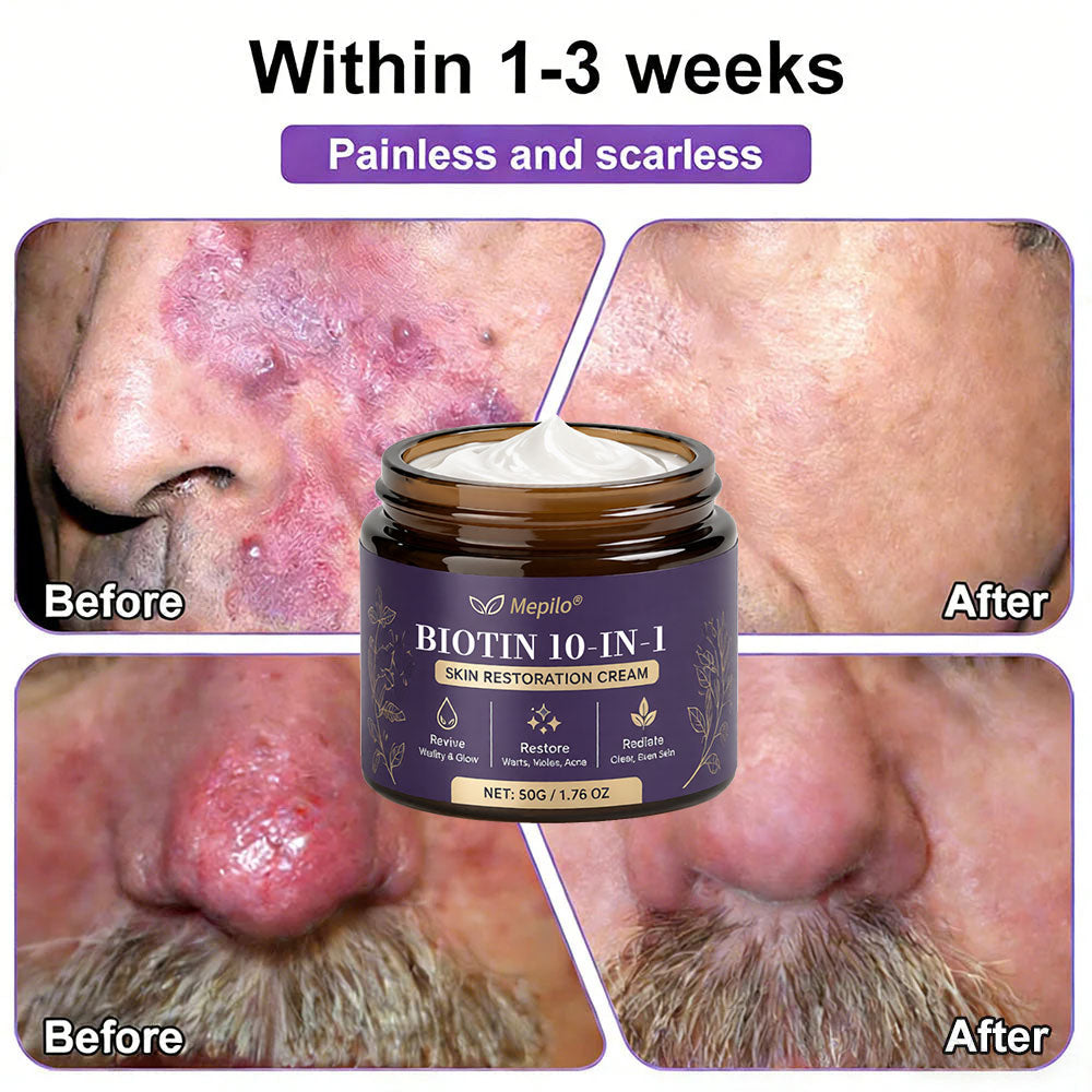 Made and Shipped from USA ✨Mepilo® Biotin 10-in-1 Skin Restoration Cream 🍀