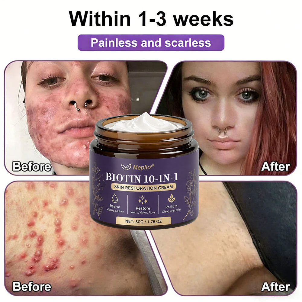 Made and Shipped from USA ✨Mepilo® Biotin 10-in-1 Skin Restoration Cream 🍀