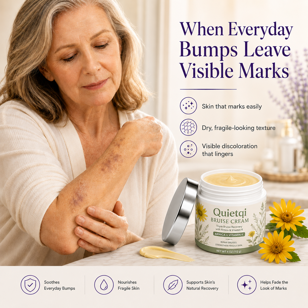 ⭐ Trusted by 100,000+ Customers – Quietqi Bruise Recovery Cream