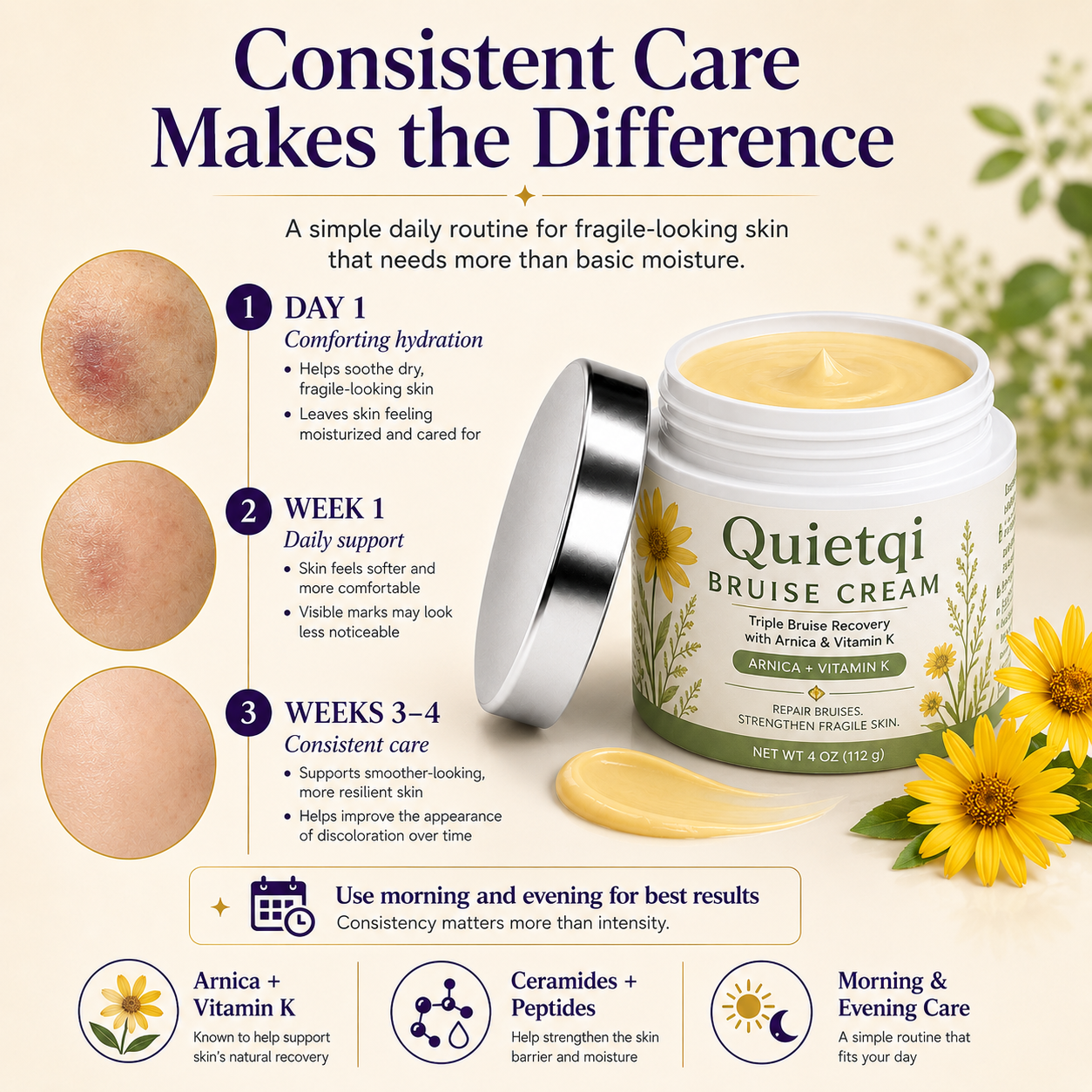 ⭐ Trusted by 100,000+ Customers – Quietqi Bruise Recovery Cream