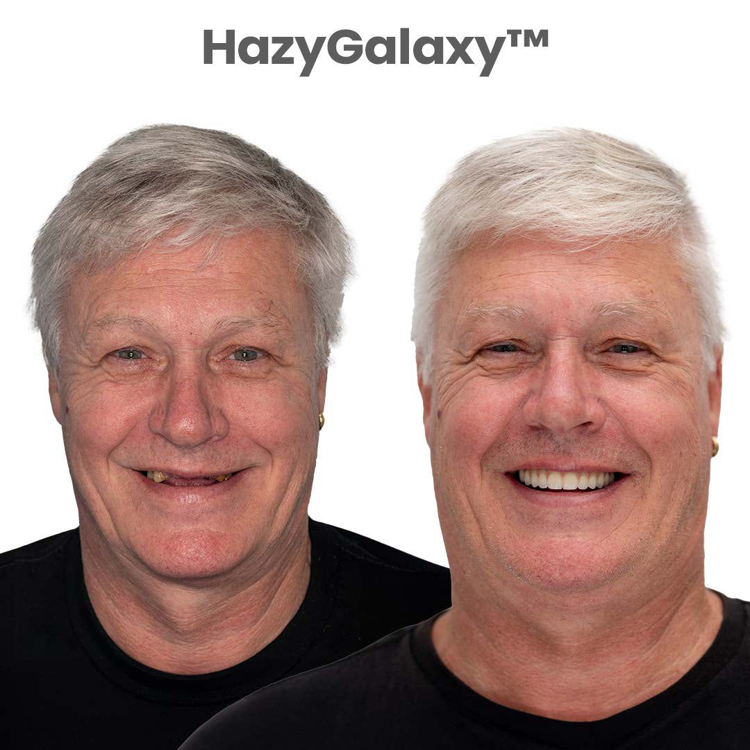 💖 🦷 HazyGalaxy™ Custom-Fit Dentures ⏰ ENDS TODAY   70% OFF | Smile with Confidence